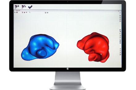 Exemple d' empreintes scannées en 3D, en bleu la gauche et en
rouge la droite Scan 3D des empreintes d' oreilles
